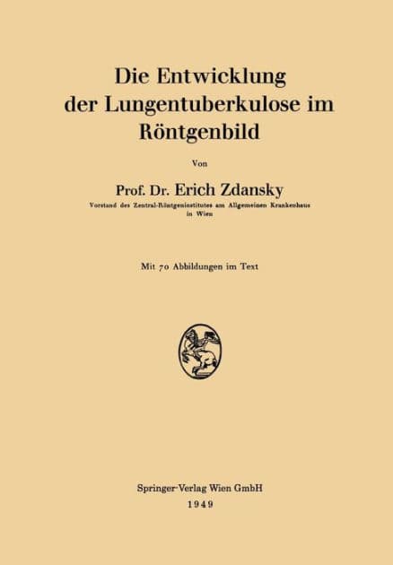 Die Entwicklung der Lungentuberkulose im Rï¿½ntgenbild by Erich Zdansky