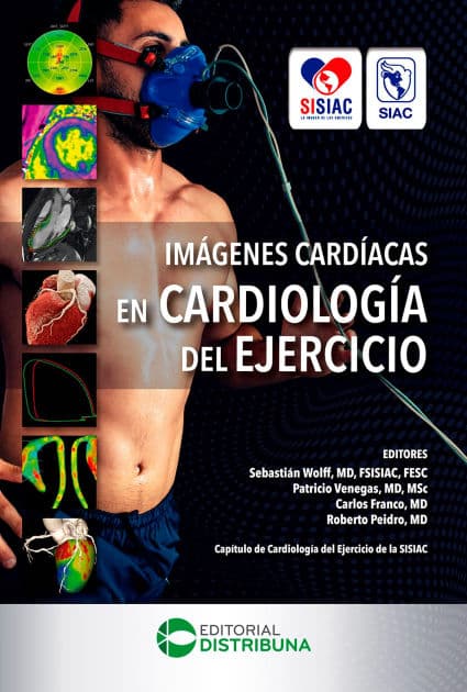 Imágenes Cardíacas en Cardiología del Ejercicio by Sebastián Wolff