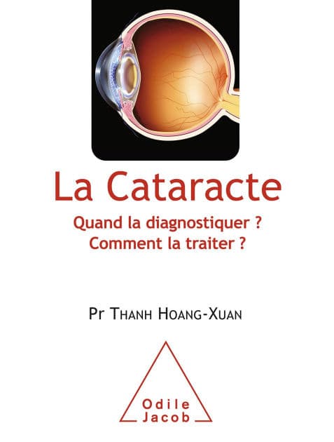 La Cataracte: Quand la diagnostiquer ? Comment la traiter ? by Thanh Hoang-Xuan