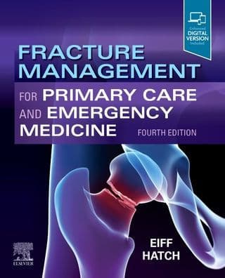 Fracture Management for Primary Care and Emergency Medicine / Edition 4 by M. Patrice Eiff MD, MPH, Robert L. Hatch MD