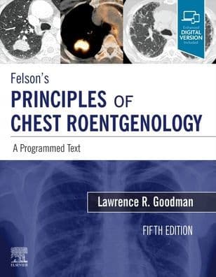 Felson's Principles of Chest Roentgenology, A Programmed Text: A Programmed Text by Lawrence R. Goodman MD
