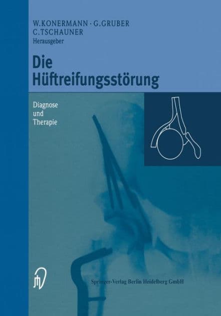 Die Hï¿½ftreifungsstï¿½rung: Diagnose und Therapie by Werner Konermann
