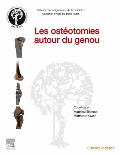 Les ostéotomies autour du genou by Matthieu Ehlinger