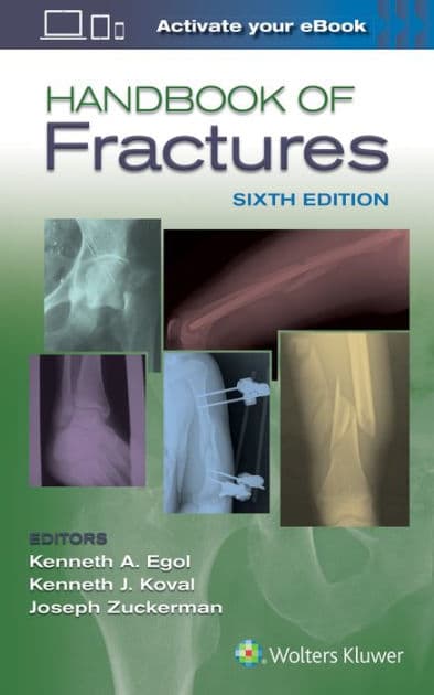 Handbook of Fractures by Kenneth Egol MD