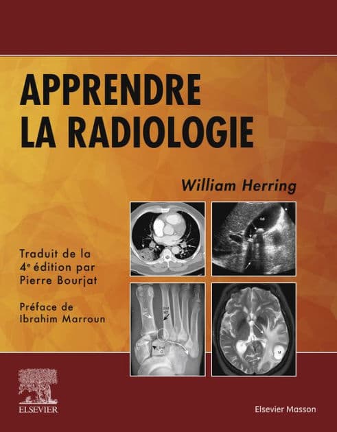 Apprendre la radiologie by FACR Herring MD