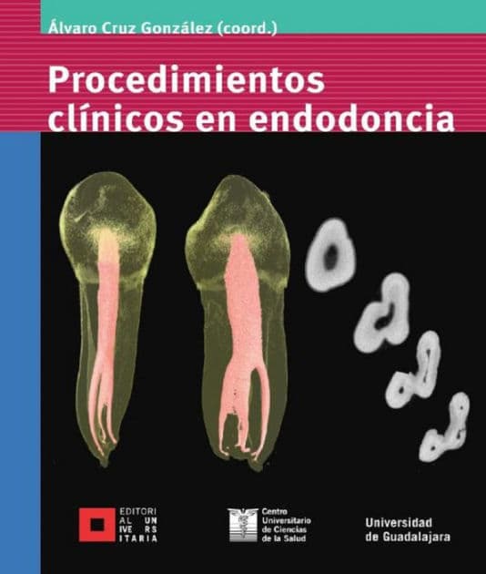 Procedimientos clínicos en endodoncia by Álvaro Cruz González