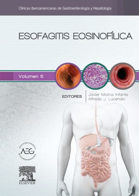 Esofagitis eosinofílica: Clínicas Iberoamericanas de Gastroenterología y Hepatología vol. 5 by Javier Molina Infante