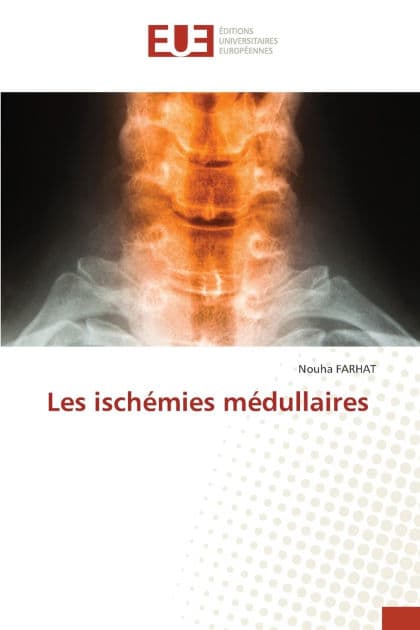 Les ischï¿½mies mï¿½dullaires by Nouha Farhat