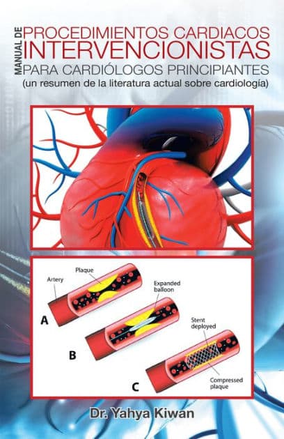 Manual De Procedimientos Cardiacos Intervencionistas Para Cardiólogos Principiantes: (Un Resumen De La Literatura Actual Sobre Cardiología) by Dr. Yahya Kiwan