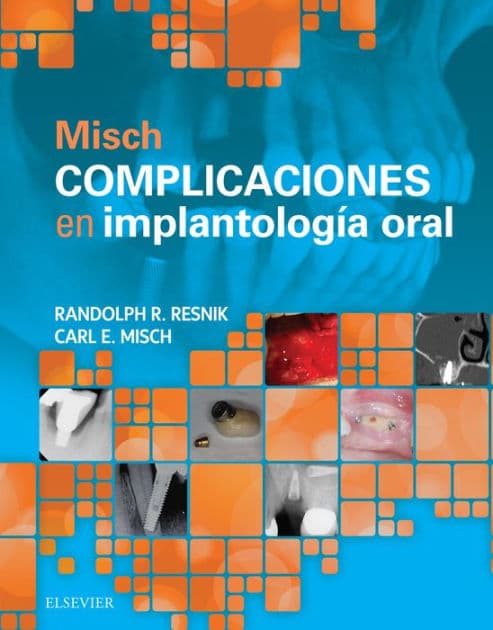 Misch. Complicaciones en implantología oral by Randolph Resnik DMD