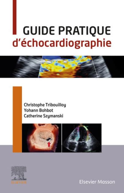 Guide pratique d'échocardiographie by Christophe Tribouilloy