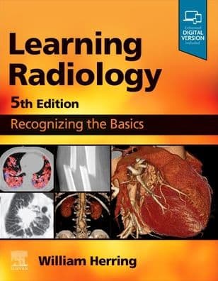 Learning Radiology: Recognizing the Basics by William Herring MD