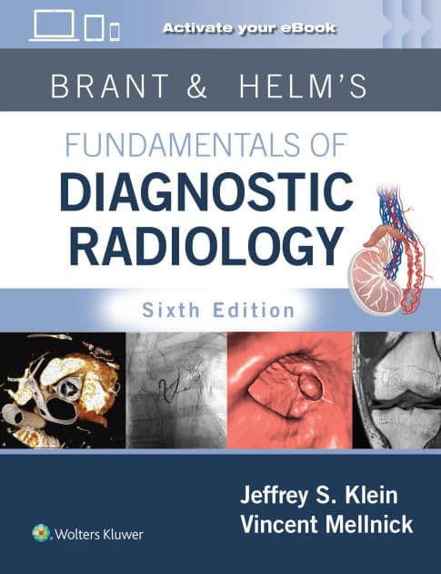 Brant & Helms' Fundamentals of Diagnostic Radiology: Print + eBook with Multimedia by Jeffrey Klein MD