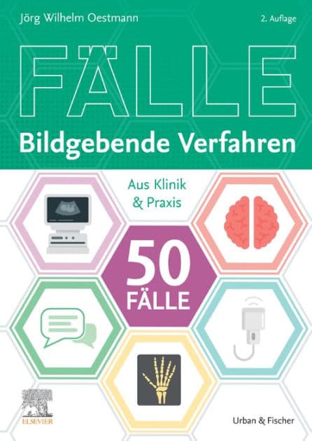Die 50 wichtigsten Fälle Bildgebende Verfahren: Die 50 wichtigsten Fälle Bildgebende Verfahren by Jörg Wilhelm Oestmann