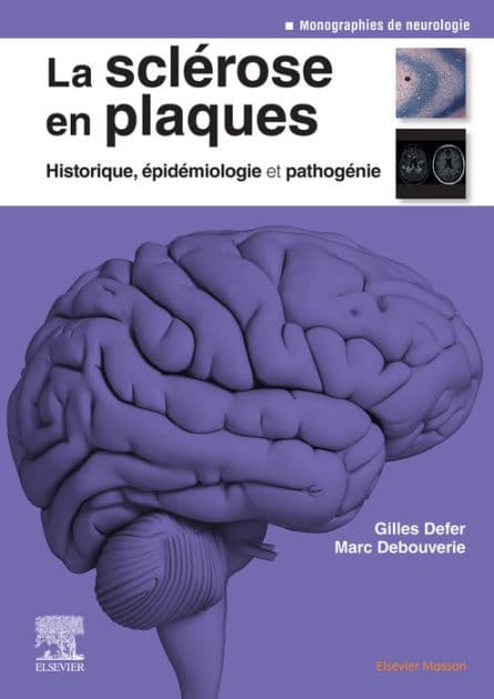 La sclérose en plaques - Historique, épidémiologie et pathogénie by Gilles Defer