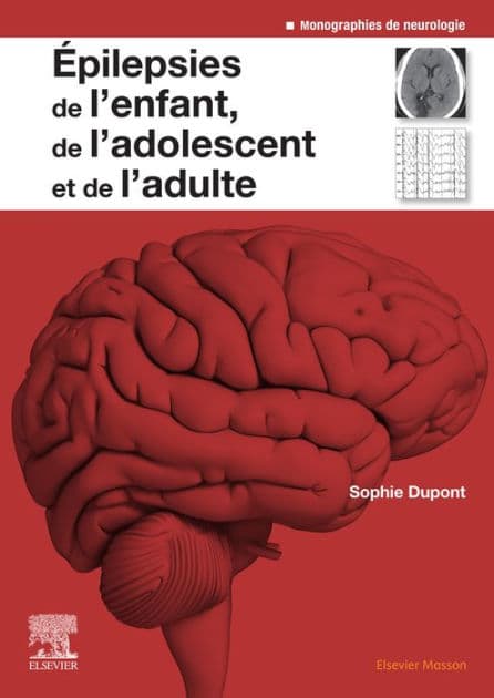 Epilepsies de l'enfant, de l'adolescent et de l'adulte: De la physiopathologie à la prise en charge by Sophie Dupont