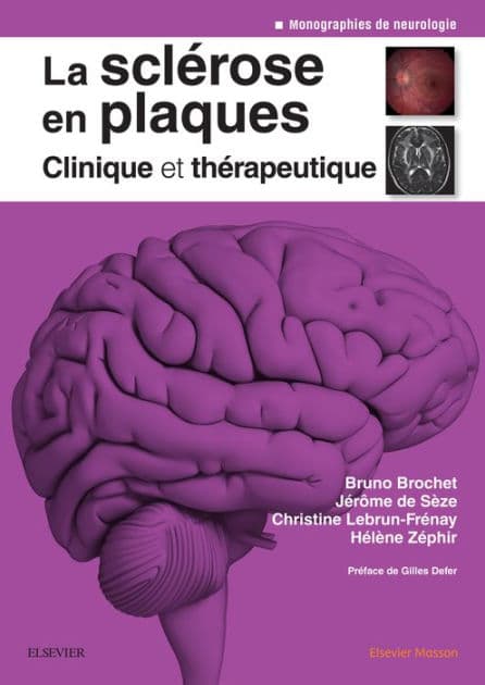 La sclérose en plaques - Clinique et thérapeutique by Bruno Brochet