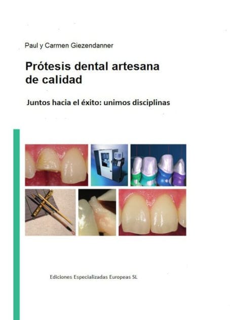 Prótesis dental artesanal de calidad: Juntos hacía el éxito: unimos disciplinas