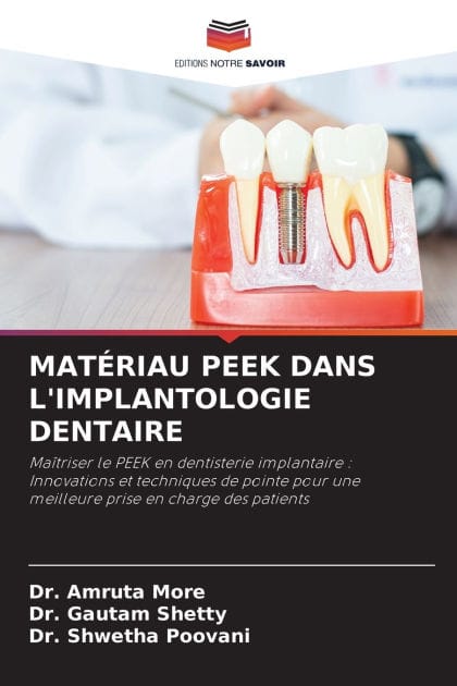 Matï¿½riau Peek Dans l'Implantologie Dentaire