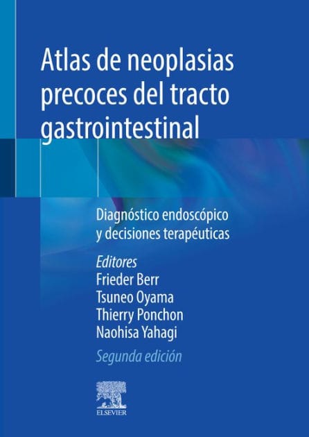 Atlas de neoplasias precoces del tracto gastrointestinal: Diagnóstico endoscópico y decisiones terapéuticas