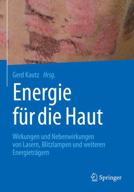 Energie fï¿½r die Haut: Wirkungen und Nebenwirkungen von Lasern, Blitzlampen und weiteren Energietrï¿½gern