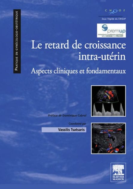 Le retard de croissance intra-utérin: Aspects cliniques et fondamentaux