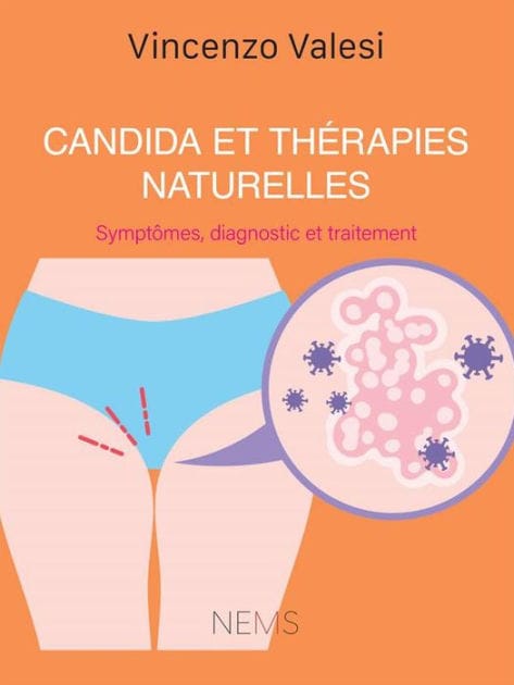 Candida et Thérapies naturelles: Symptômes, diagnostic et traitement