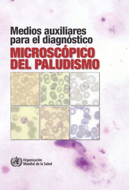 Medios auxiliares para el diagnóstico microscópico del paludismo