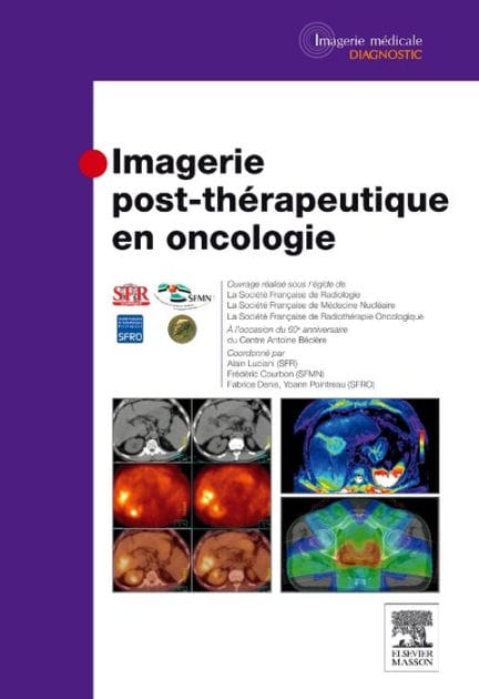 Imagerie post-thérapeutique en oncologie
