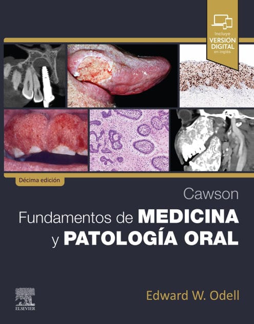 Cawson. Fundamentos de medicina y patología oral