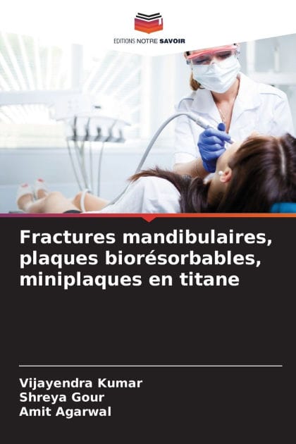 Fractures mandibulaires, plaques biorï¿½sorbables, miniplaques en titane