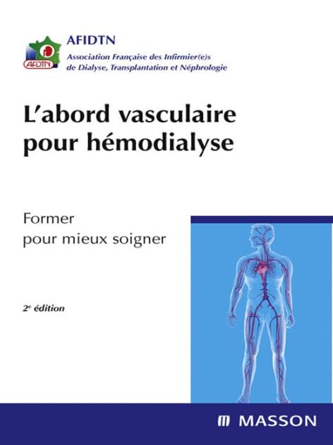 L'abord vasculaire pour hémodialyse: Former pour mieux soigner