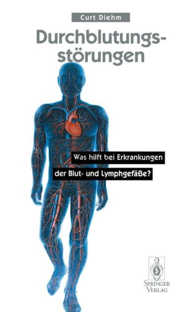 Durchblutungsstï¿½rungen: Was hilft bei Erkrankungen der Blutund Lymphgefï¿½ï¿½e?