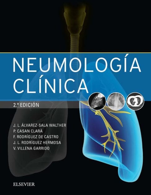 Neumología clínica