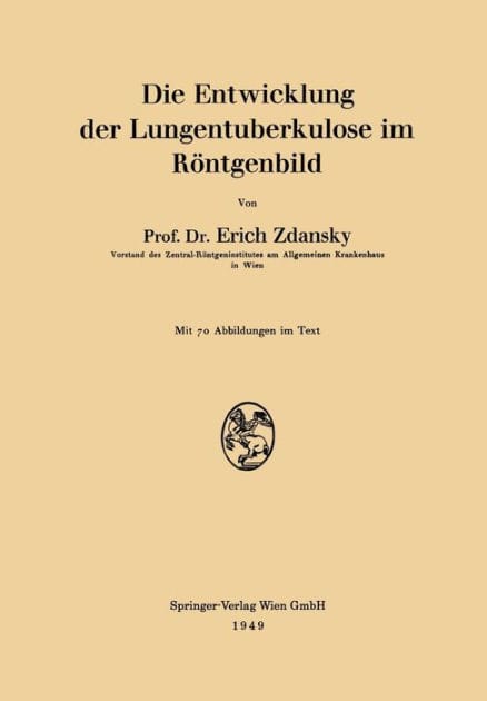 Die Entwicklung der Lungentuberkulose im Rï¿½ntgenbild