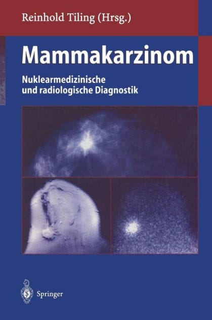 Mammakarzinom: Nuklearmedizinische und radiologische Diagnostik