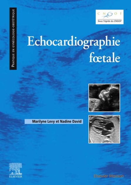 Echocardiographie fotale