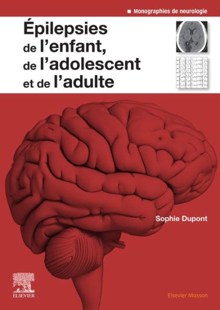 Epilepsies de l'enfant, de l'adolescent et de l'adulte: De la physiopathologie à la prise en charge