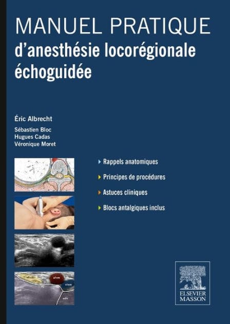 Manuel pratique d'anesthésie locorégionale échoguidée