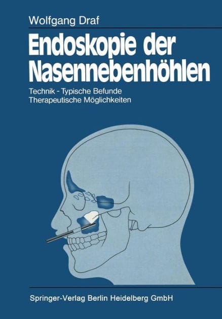 Endoskopie der Nasennebenh�hlen: Technik � Typische Befunde, Therapeutische M�glichkeiten