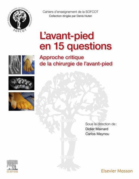 L'avant-pied en 15 questions: Approche critique de la chirurgie de l'avant-pied